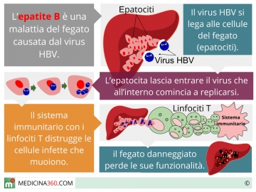 Trasmissione epatite b cronica