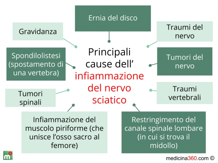 Sciatic Nerve Pain Treatments