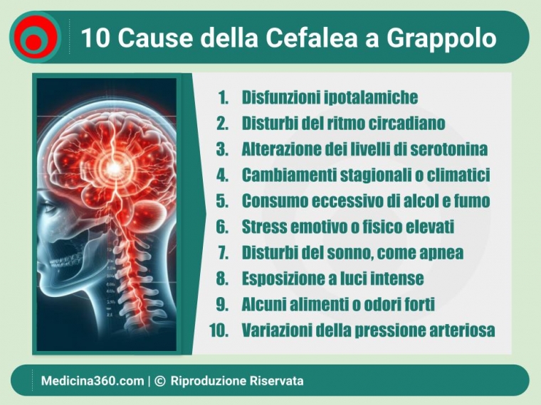 Cause della Cefalea a Grappolo: Una Guida Completa e Dettagliata