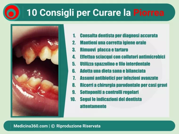 Piorrea: Cura, Prevenzione e Vita Quotidiana