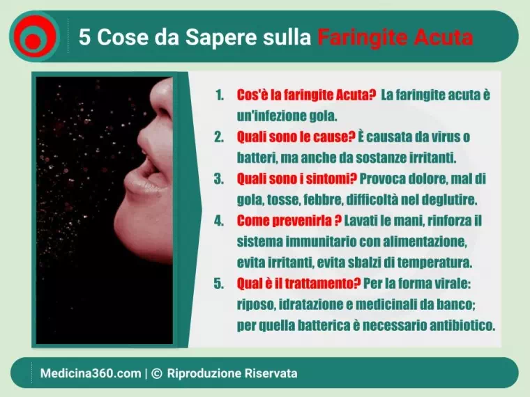 Guida Completa alla Faringite Acuta: Sintomi, Diagnosi e Trattamenti