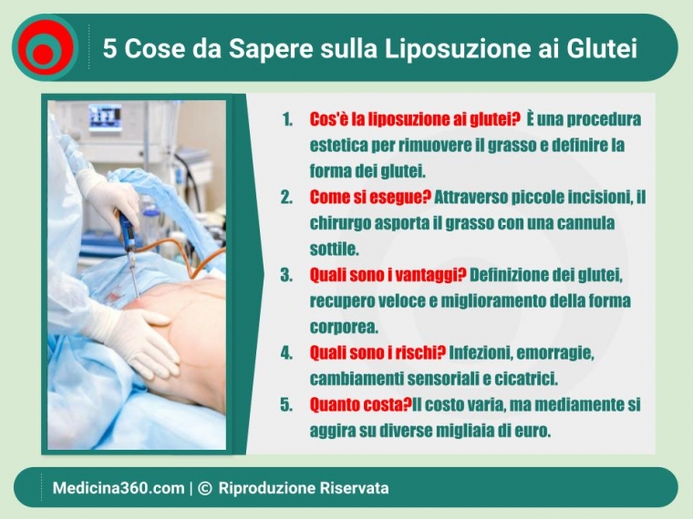 Liposuzione ai Glutei: Guida Completa per Risultati Perfetti